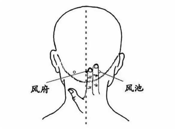 春季“风病”?两个穴位帮过敏患者抵御风风邪 春季“风病”?两个穴位帮过敏患者抵御风风邪